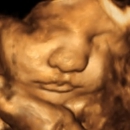 ShoMe Prenatal Imaging - Medical Service Organizations
