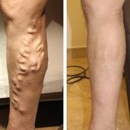 Southern Vein Care - Physicians & Surgeons, Vascular Surgery