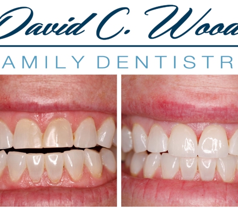 David Wood Family Dentistry - Carmel, IN