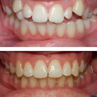 Glenn Carty Orthodontist - Gungahlin, ACT