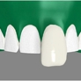 New Image Dental, LLC - Fords, NJ