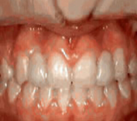 Marsh Orthodontics - William F Marsh DDS - Tampa, FL