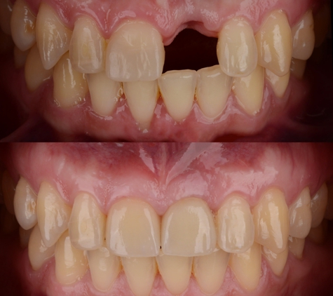 Smile Perfection Orthodontics - Pembroke Pines, FL