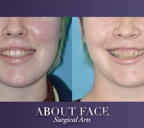 About Face Surgical Arts: Khurram A. Khan BDS, DMD - Cincinnati, OH