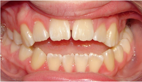 Active Orthodontics - Pialba, QLD