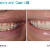 Cosmetic Dentistry of Atlanta gallery