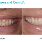 Cosmetic Dentistry of Atlanta