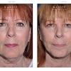 Facial Cosmetic Surgery Associates gallery