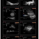 Marc H Simonson - MRI (Magnetic Resonance Imaging)