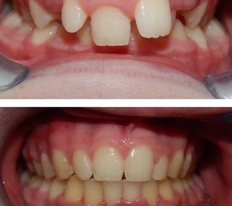 Glenn Carty Orthodontist - Gungahlin, ACT