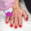 LaserAway Paramus - Hair Removal