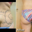 Avalon Lipo & Aesthetics - Physicians & Surgeons, Plastic & Reconstructive