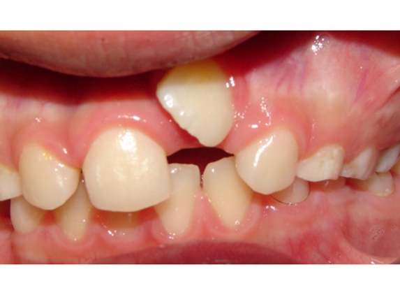 Active Orthodontics - Bundaberg South, QLD
