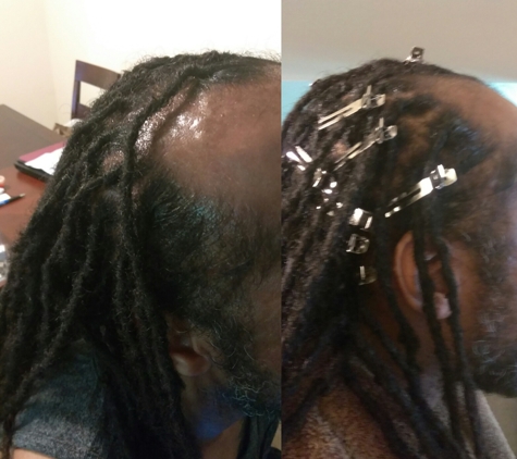 Ms Tease Hair Suite (MTHS). Loc Maintenance