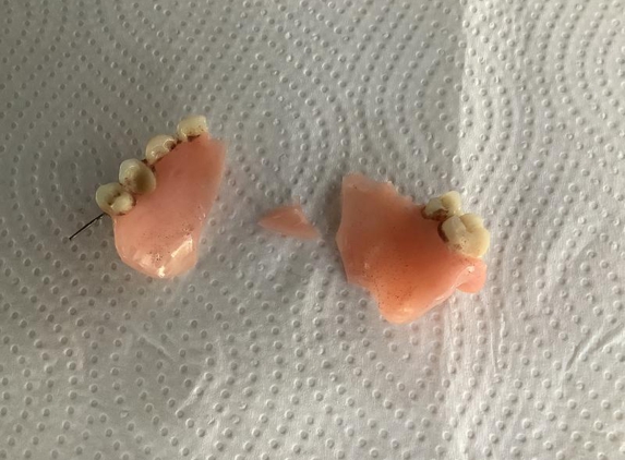 Mobile Smiles denture care - Woy Woy, NSW. My broken denture before it was fixed