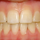Dupont Orthodontics: Dr. Allison S. Bergdoll, DDS, MS