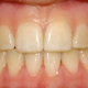 Dupont Orthodontics: Dr. Allison S. Bergdoll, DDS, MS