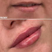 Gallery Image Number 1