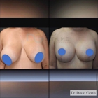 4 Beauty Aesthetics Institute for Plastic Surgery: Dr. Constantino Mendieta