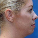 Facial Plastic Surgery Center - Cosmetic Services