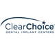 ClearChoice-San Jose