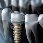 Touchstone Dental & Implants