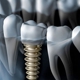 Touchstone Dental & Implants