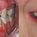 Advanced Prosthetics & Orthotics - Cosmetic Dentistry