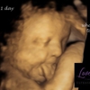 Love View 3D/4D Ultrasound Studio gallery