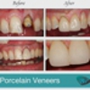 Smile Angels of Beverly Hills - Bruce Vafa DDS. gallery
