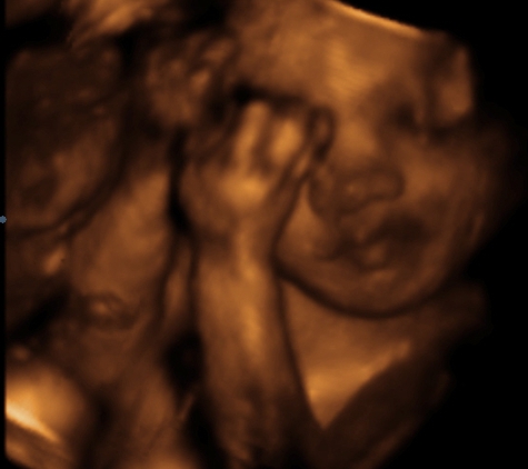 Sneak-A-Peek Prenatal Imaging of Mobile - Mobile, AL