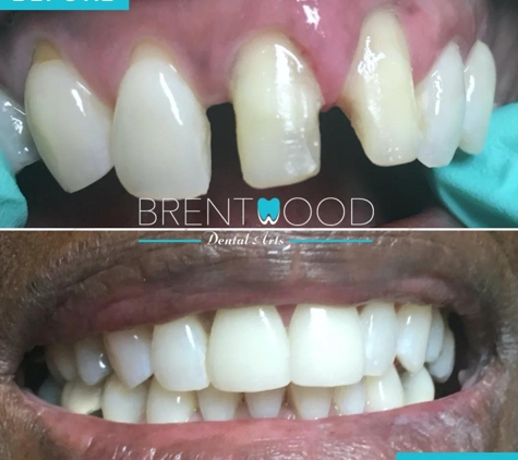 Brentwood Dental Art - Los Angeles, CA