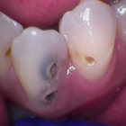 Smile Dental Care - Dr. Steven T. Nguyen DDS