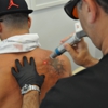 ReversaTatt Tattoo Removal gallery