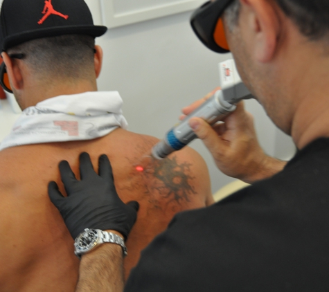 ReversaTatt Tattoo Removal - Naples, FL