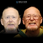 Smile Now Portland Dentures and Implants