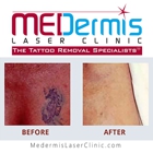 MEDermis Laser Clinic