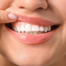 Dixon Dental Center - Cosmetic Dentistry