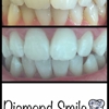 Diamond Smile Whitening gallery