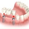 Prosthodontic Associates gallery