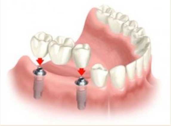 Prosthodontic Associates - Saint Paul, MN