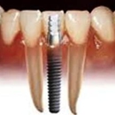 Robert L. Kasting, D.M.D - Implant Dentistry