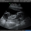 Peekaboo Imaging Studio gallery