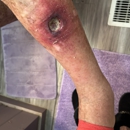 Arkansas Dermatology - Physicians & Surgeons, Dermatology