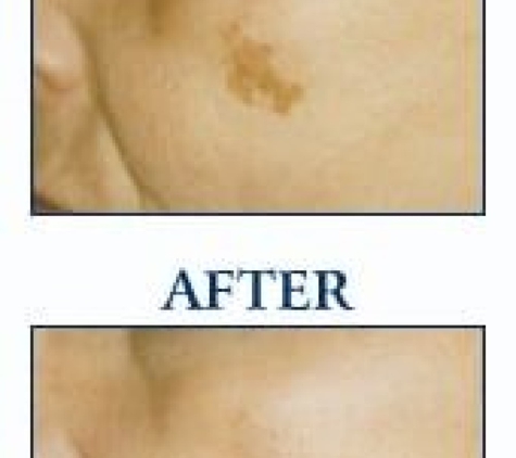 Idaho Dermatologic Surgery & Laser Center - Boise, ID