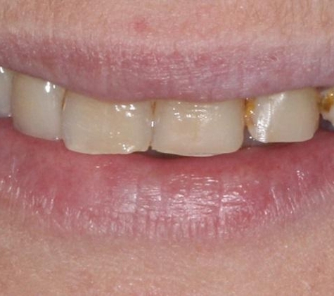 GoldCity Dental Centre - Charters Towers City, QLD