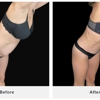 Campanile Plastic Surgery: Dr. Francesco Campanile gallery