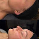 Ashley Skin Esthetics - Beauty Salons