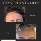 Arocha Hair Restoration