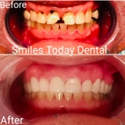 Smiles Today Dental